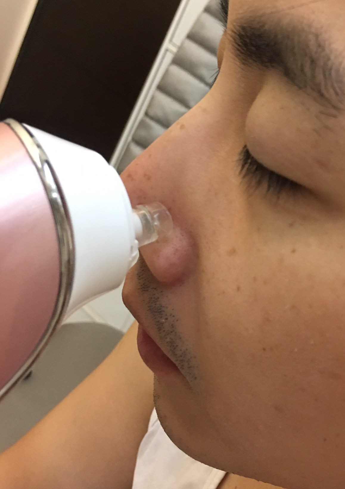 【彩妝保養】 KA’FEN粉刺小心肌♥開箱文來囉♥